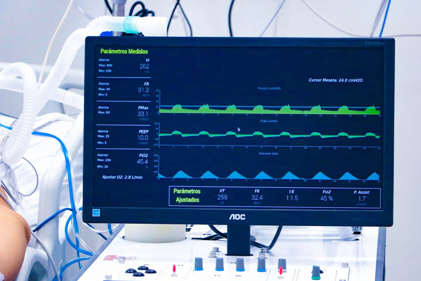 cuanto tiempo paciente conectado respirador artificial